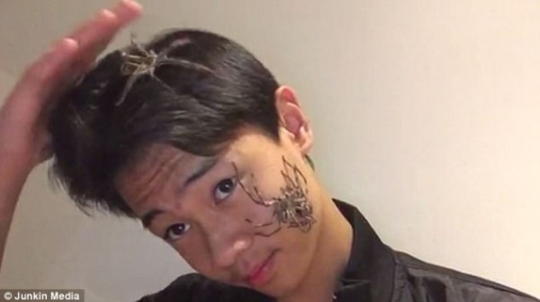 城会玩!澳大利亚亚裔男脸上放毒蜘蛛玩自拍