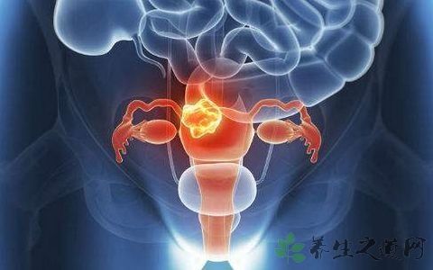 宫颈癌筛查几天出结果