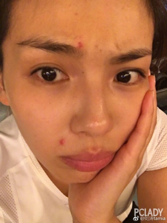 就连我们美颜盛世的angelababy在高清的镜头下,额头的痘痘真是无情