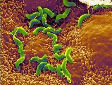 如何根治幽门螺杆菌?医生告诉你怎么做!