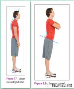 案例分析|针对骨盆前倾、上交叉综合征体态运