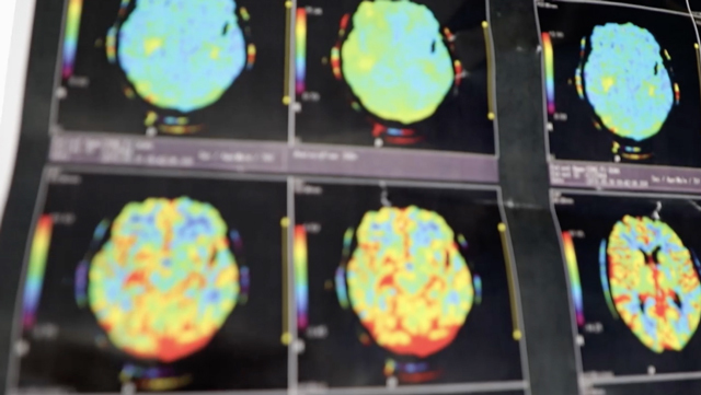 除了生死 神经科门诊见到的还有人性! 除了生死 神经科门诊见到的还有人性!