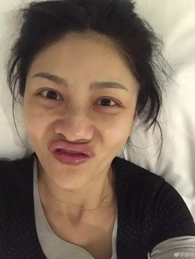 胡可五官变形,陈意涵双眼皮吓人,女明星为曝素