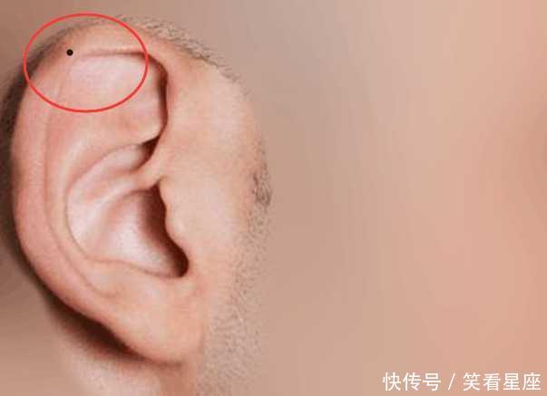 人身上这个地方长痣,容易肾气不足,影响生育和