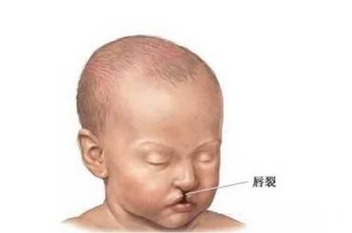 孕妇心境起伏太大,会导致胎儿大脑发育不良甚至畸形.