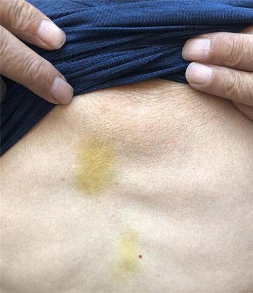 中国游客遭瑞典警方拖打遗弃坟场 中方提严正