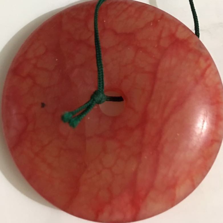 为什么脸上长痘痘和毛孔变大?脸颊和额头长痘