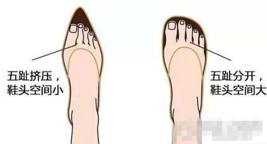 女孩看进来!这4类鞋别穿了 第2种比高跟鞋还伤