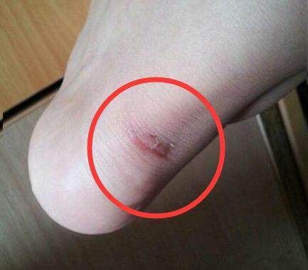 女模特们穿高跟鞋站一天,为啥就是不累脚?原来