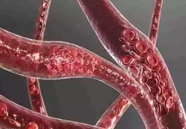 手麻--不可忽视的求救信号