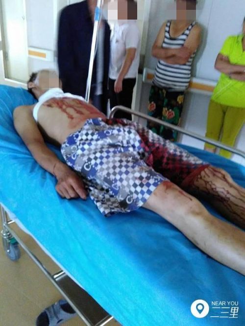 铁岭男子遭妻子用刀