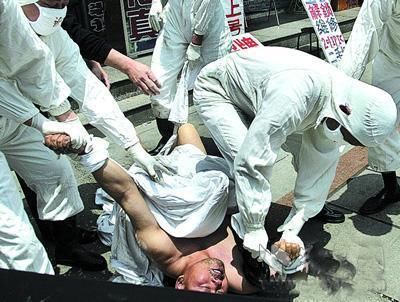 狂犬病引起的恐怖临床反应,北京一男子死前一