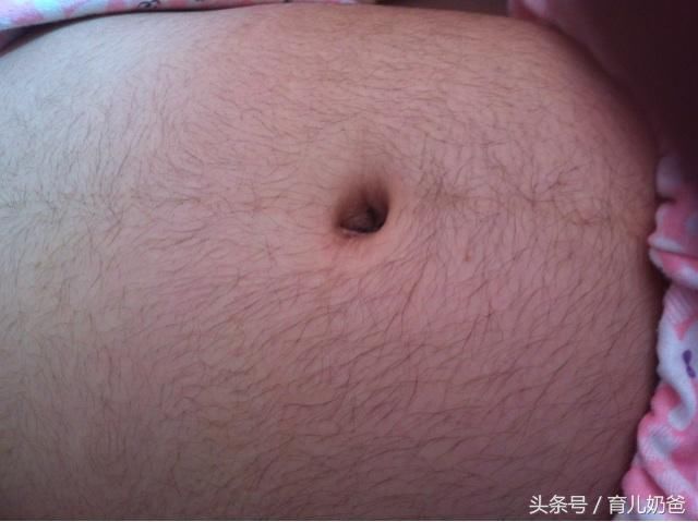 怀孕后肚子长毛,有人说是男孩,事实真的如此吗