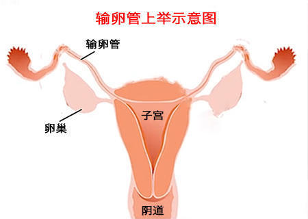 输卵管上举是什么意思?你了解吗?