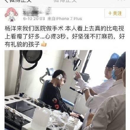 杨洋做整容手术? 杨洋所谓手术其实就是挑了一