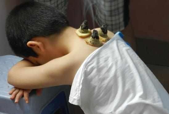 小孩艾灸身柱有什么好处?有效通治儿科百病