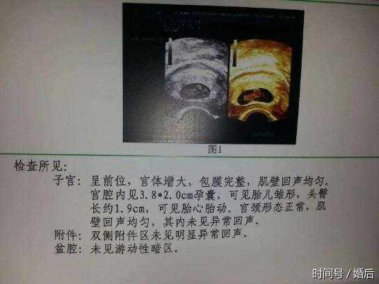 怀孕9个月,半夜羊水破了,他的做法让我决定生