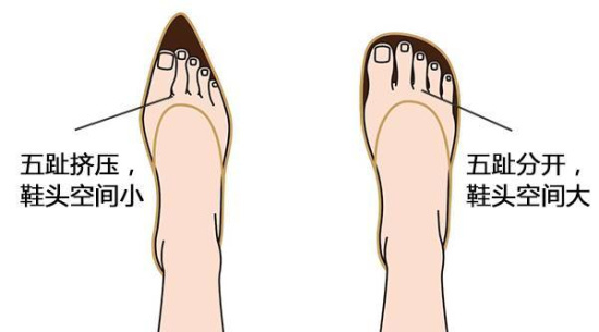 夏天穿鞋好看与好穿难两全?这四种鞋最伤脚