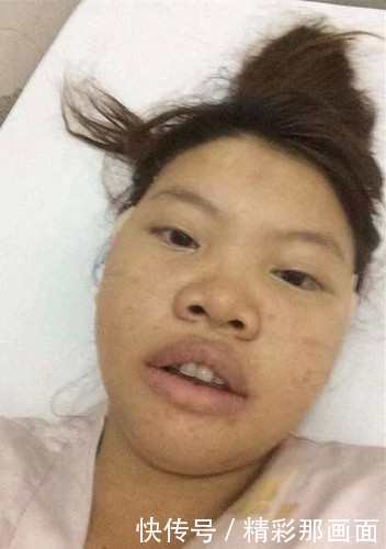 她长得不好看,倒贴都没人要,她去了医院后傍上了富二代!
