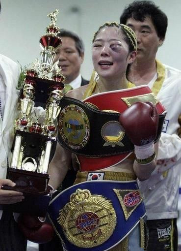 我想，她拿到奖金后一定第一时间赶到整容医院去做手术吧...