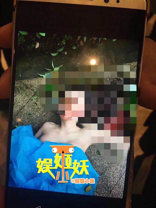 女星从酒店13层赤裸跳下 同房男演员涉案被查 女星从酒店13层赤裸跳下 同房男演员涉案被查