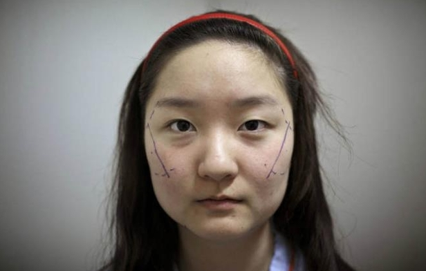 韩国女孩因自卑跑去整容,手术成功后她却哭了