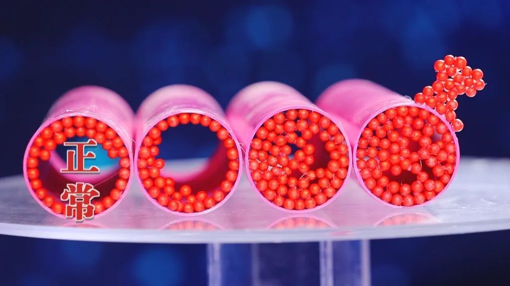 乳腺机是什么【养生堂】今日17:25播出 《警惕高发的老年乳腺危机》_北京时间_新闻资讯_第9张_活检穿刺产品网 乳腺机是什么【养生堂】今日17:25播出 《警惕高发的老年乳腺危机》_北京时间_https://www.jmylbn.com_新闻资讯_第9张