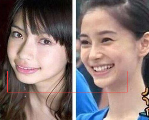 鼻子一捏就塌!女星整容后遗症开始了?杨幂直接