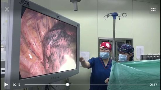 吸烟30年肺上积满灰 戒烟15载变回普通人