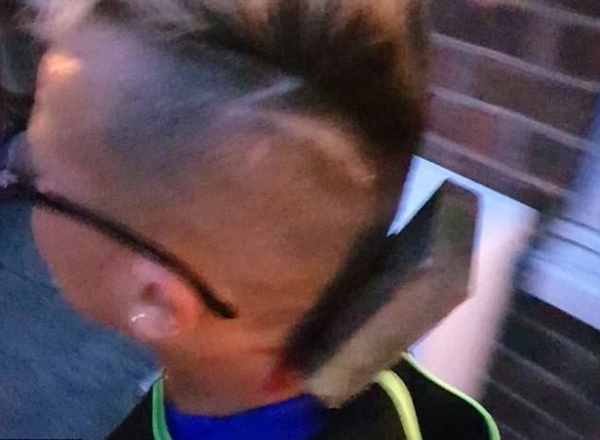 欺人太甚!英自闭症男孩路遇恶霸头被插钉子 欺人太甚!英自闭症男孩路遇恶霸头被插钉子