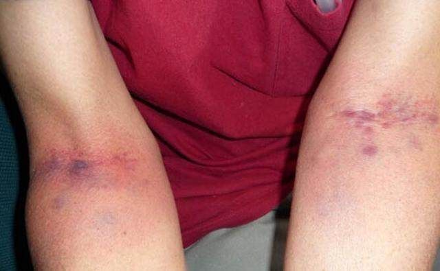 每天坚持喝它,一周不到体内湿气褪去大半!