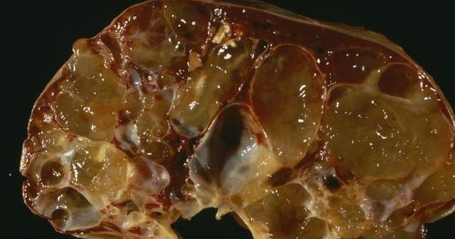 喝酒后身体这2个地方发红的人,不能喝酒,肝脏