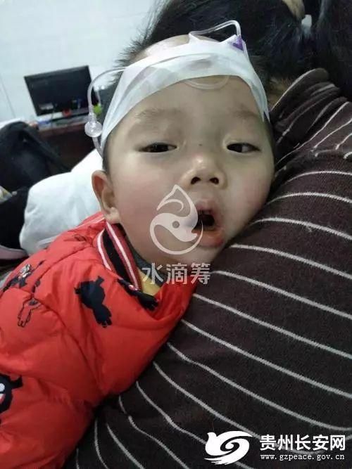 温情贵州政法干警19小时募捐50万救助两岁的