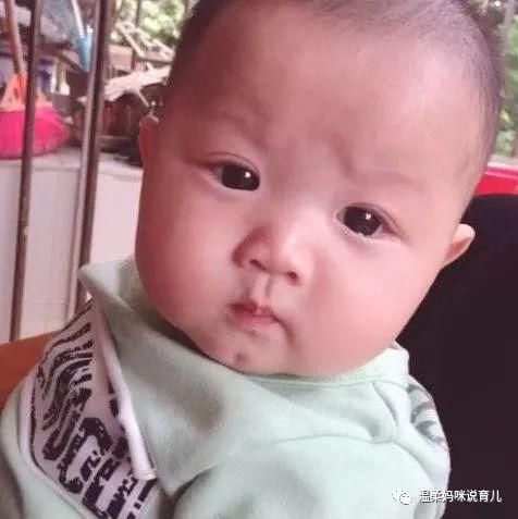 为什么宝宝一生病,单眼皮就会变双眼皮?你家宝