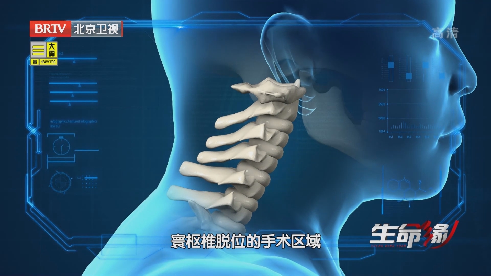 《生命缘》20211116我在骨科当“木工”