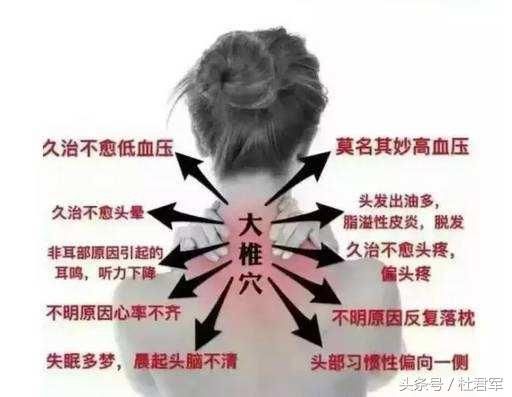 你知道富贵包,那你了解颈椎脂肪垫吗