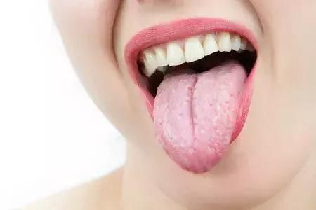 看舌头,知病况?了解关于舌头健康的二三事
