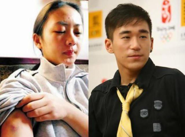 张默为什么要打童瑶?七年之后终于公开了真相