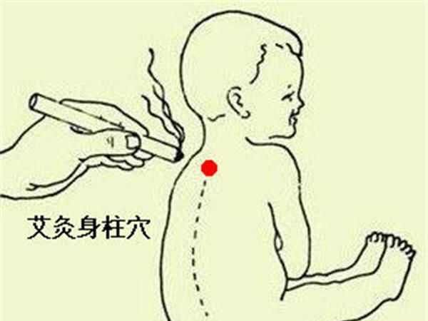 小孩艾灸身柱有什么好处?有效通治儿科百病