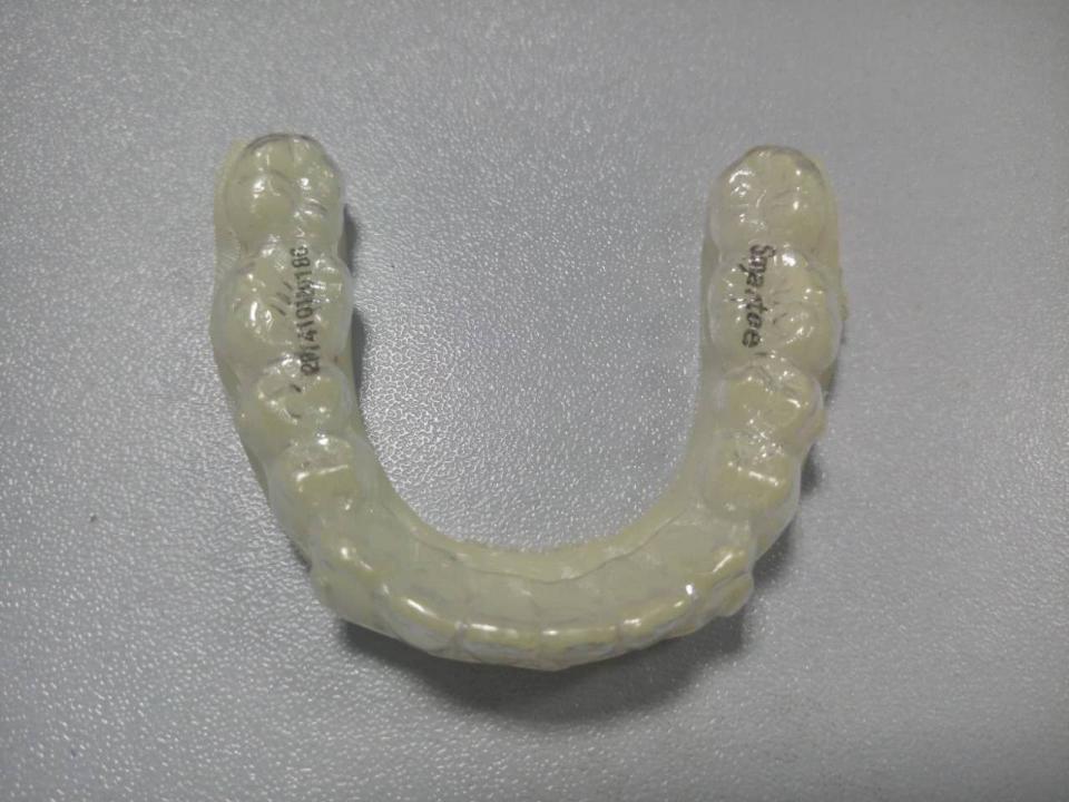 整牙日记3 ▏金属,陶瓷,隐形,哪种牙套不拔牙,见效快又不贵?