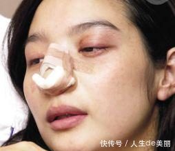 最惨女星度蜜月被砍手指、怀孕时被踢流产,今