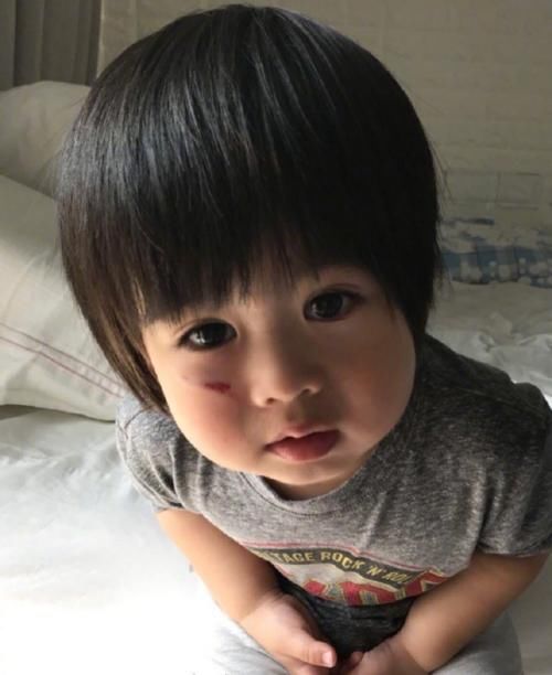 林志颖儿子跌伤脸 Kyson大眼呆萌不惧伤口模样