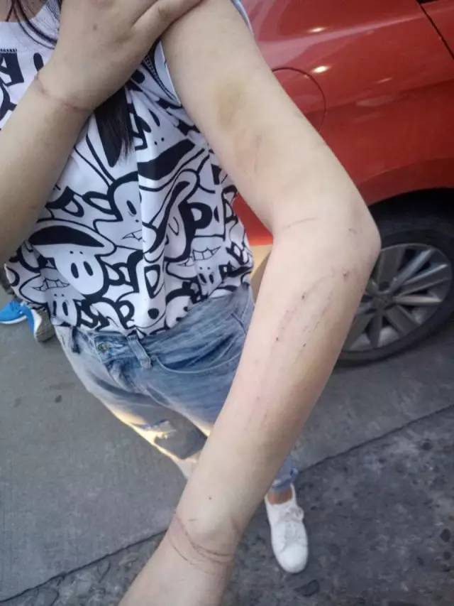 天呐!漳州街头一少女玩