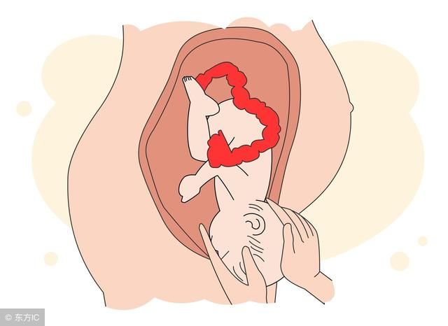怀孕32周胎儿提早入盆了,入盆是什么感觉?早入