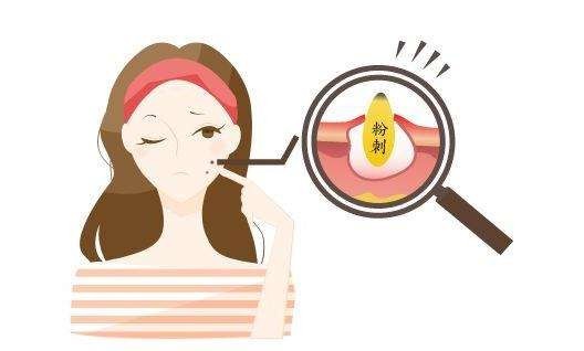 深圳肤康皮肤科解说鼻子上挤出来的白点,原来