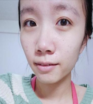 生活中常见的几元一瓶的白醋,每天脸上擦一擦