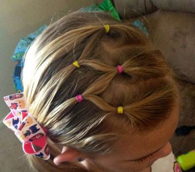 头皮里长疙瘩,不痛不痒是怎么回事?