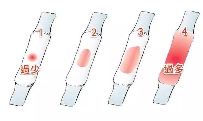 正常的月经出血应为20~60毫升.