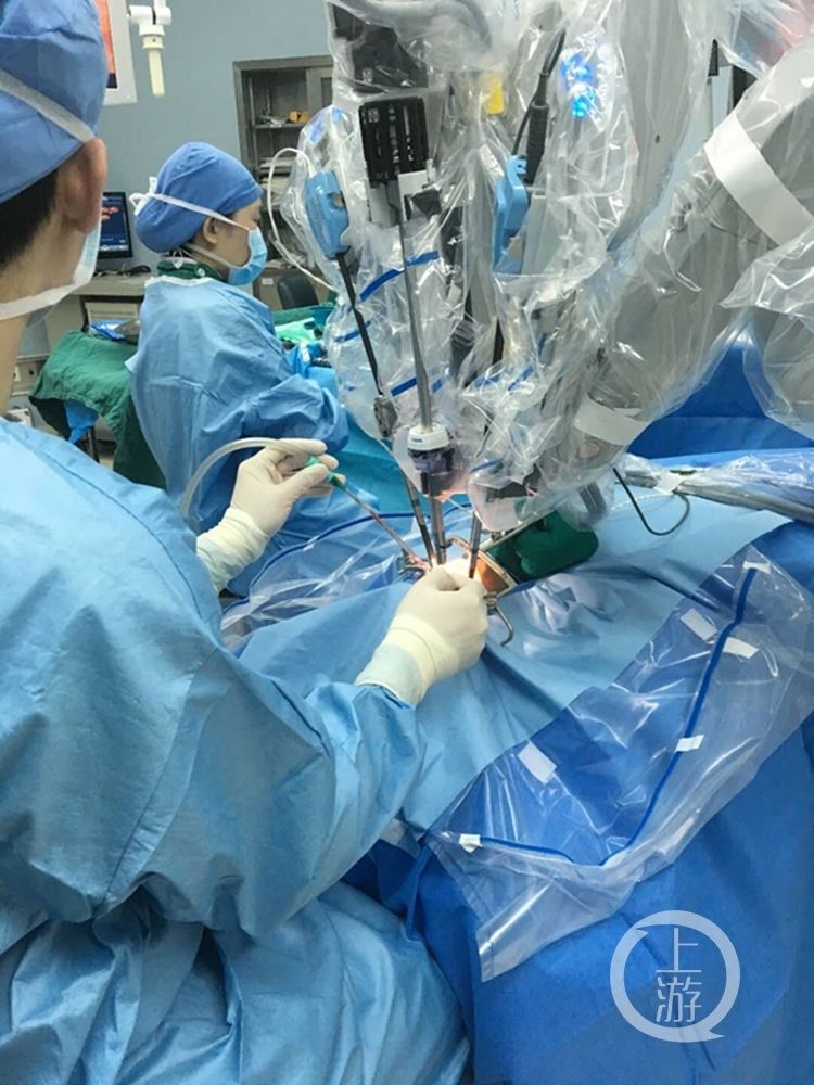 西南首例 机器人主刀为口咽部肿瘤患者做手术