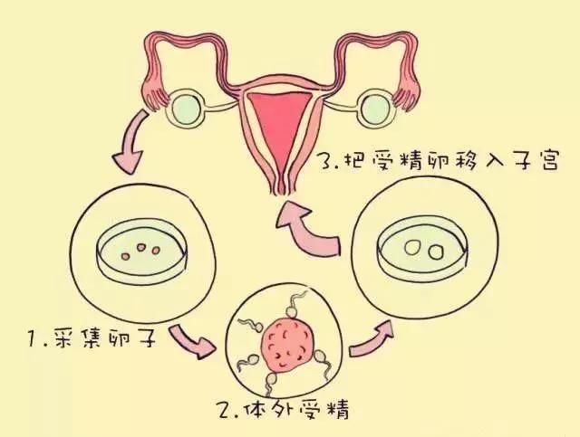 供卵做试管超长方案适合什么人群,子宫腺肌症适合吗